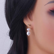 Auricular needle